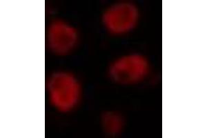 ABIN6274356 staining COLO205 cells by IF/ICC. (HLX antibody  (Internal Region))