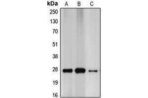 Western blot analysis of p27 Kip1 expression in MCF7 (A), HEK293T (B), PC12 (C) whole cell lysates.