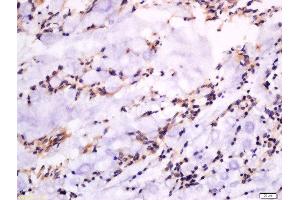 Formalin-fixed and paraffin embedded rat rectum labeled with Anti-GSDMA Polyclonal Antibody, Unconjugated  at 1:300 followed by conjugation to the secondary antibody and DAB staining. (Gasdermin A antibody  (AA 21-120))