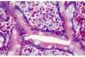 Human Small Intestine: Formalin-Fixed, Paraffin-Embedded (FFPE) (Caspase 7 antibody)