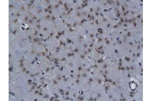 Formalin-fixed and paraffin embedded rat brain labeled with Anti- NIT2 Polyclonal Antibody, Unconjugated  followed by conjugation to the secondary antibody and DAB staining (NIT2 antibody  (AA 41-140))