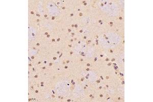 Immunohistochemistry of paraffin embedded rat brain using SR140 (ABIN7076091) at dilution of 1:1000 (400x lens) (SR140 antibody)
