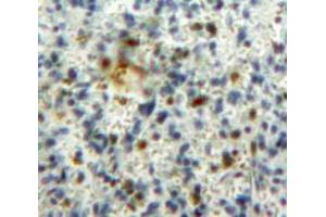 IHC-P analysis of Spleen tissue, with DAB staining. (GM-CSF antibody  (AA 18-144))