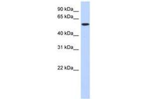 Image no. 1 for anti-Deoxynucleotidyltransferase, terminal (DNTT) (C-Term) antibody (ABIN6743611) (TdT antibody  (C-Term))