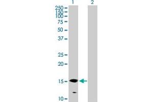 Western Blot analysis of GALNT3 expression in transfected 293T cell line by GALNT3 MaxPab polyclonal antibody. (GALNT3 antibody  (AA 1-141))