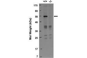 Immunoblot against lysates from wild-type (+/+) and RGS14 knockout (-/-) mouse brains probed with N133/21. (RGS14 antibody  (AA 1-544))