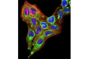 Immunocytochemistry (ICC) image for anti-Transcription Termination Factor, RNA Polymerase I (TTF1) (AA 1-150) antibody (ABIN5542340)