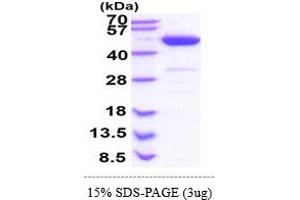 phosphoribosylaminoimidazole Carboxylase, phosphoribosylaminoimidazole Succinocarboxamide Synthetase (PAICS) (AA 1-425) protein (His tag)