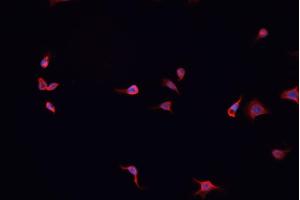 ABIN6267044 staining A-431 cells by IF/ICC.