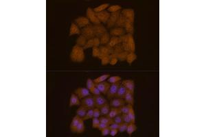 Immunofluorescence analysis of HeLa cells using Galectin 3/LG Rabbit mAb (ABIN7267337) at dilution of 1:50 (40x lens). (Galectin 3 antibody)