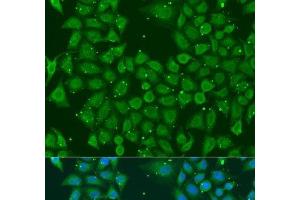 Immunofluorescence analysis of U2OS cells using AKR7A3 Polyclonal Antibody at dilution of 1:100. (AKR7A3 antibody)