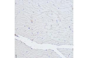 Immunohistochemistry of paraffin-embedded rat skeletal muscle using  Rabbit pAb (ABIN6127422, ABIN6136487, ABIN6136489 and ABIN6216551) at dilution of 1:500 (40x lens). (ACTN3 antibody  (AA 580-630))