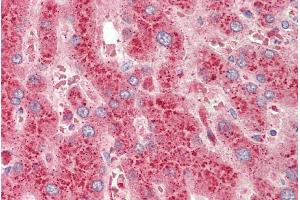 ABIN1590086 (5µg/ml) staining of paraffin embedded Human Liver. (CROT antibody  (AA 178-199))