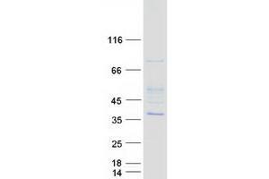 HUS1 Checkpoint Homolog (S. Pombe) (HUS1) protein (Myc-DYKDDDDK Tag)