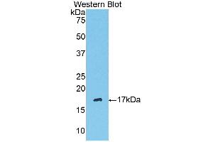 Western Blotting (WB) image for anti-Serpin Peptidase Inhibitor, Clade G (C1 Inhibitor), Member 1 (SERPING1) (AA 397-495) antibody (ABIN3208985) (SERPING1 antibody  (AA 397-495))