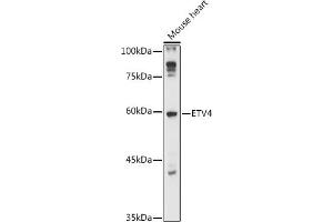 Western blot analysis of extracts of Mouse heart, using ETV4 antibody (ABIN6131216, ABIN6140331, ABIN6140333 and ABIN6218006) at 1:1000 dilution. (ETV4 antibody  (AA 79-178))