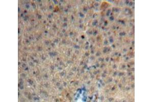 Used in DAB staining on fromalin fixed paraffin-embedded Liver tissue (HRG antibody  (AA 106-302))