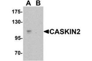 Western blot analysis of CASKIN2 in Hela cell lysate with CASKIN2 Antibody  at 1 ug/mL in (A) the absence and (B) the presence of blocking peptide. (CASKIN2 antibody  (N-Term))