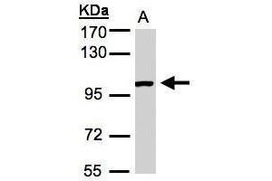 WB Image Sample (30μg whole cell lysate) A:A431, 7. (ABR antibody  (C-Term))