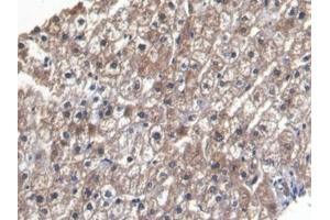 Detection of LEP in Human Liver Tissue using Monoclonal Antibody to Leptin (LEP) (Leptin antibody  (AA 22-167))