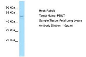 Image no. 1 for anti-Protein Disulfide Isomerase-Like, Testis Expressed (PDILT) (C-Term) antibody (ABIN6750221)