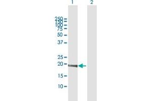 Western Blot analysis of MED9 expression in transfected 293T cell line by MED9 MaxPab polyclonal antibody.