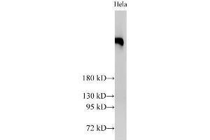 Western Blot analysis of Hela cells using BRCA2 Polyclonal Antibody at dilution of 1:2000 (BRCA2 antibody)
