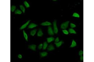 Detection of CASP8 in Hela cells using Polyclonal Antibody to Caspase 8 (CASP8) (Caspase 8 antibody  (AA 217-384))