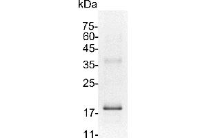 Interleukin 7 (IL7) (Active) protein (His tag)