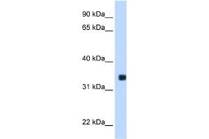 WB Suggested Anti-MLX Antibody Titration:  0. (MLX antibody  (C-Term))