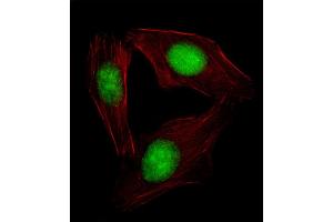 Fluorescent image of  cell stained with SREBF2 Antibody (Center) (ABIN654630 and ABIN2844326). (SREBF2 antibody  (AA 399-427))
