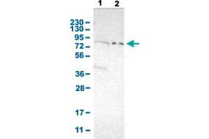 Western Blot analysis with PKP2 polyclonal antibody . (Plakophilin 2 antibody  (AA 72-194))