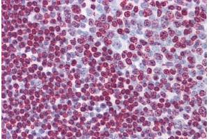 Human Tonsil: Formalin-Fixed, Paraffin-Embedded (FFPE) (ATR antibody  (AA 2545-2645))