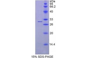 SDS-PAGE analysis of Human Azurocidin 1 Protein. (Azurocidin Protein)