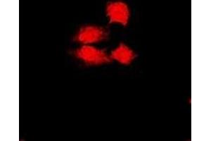 Immunofluorescent analysis of PHF17 staining in U2OS cells. (PHF17 antibody)