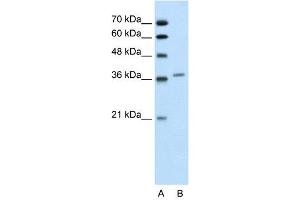 WB Suggested Anti-ALAD  Antibody Titration: 0. (ALAD antibody  (Middle Region))