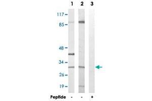 Western blot analysis of extracts from NIH/3T3 cells (Lane 1) and COLO 205 cells (Lane 2 and lane 3), using APOOL polyclonal antibody . (APOOL antibody)