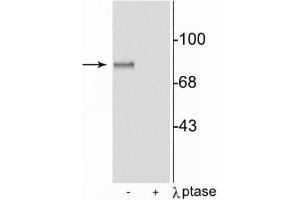 Western blot of rat brain lysate showing specific immunolabeling of the ~87 kDa MARCKS protein phosphorylated at Ser152,156, in the first lane (-). (MARCKS antibody  (pSer152, pSer156))