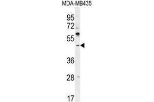 ATF4 Antibody (Center) western blot analysis in MDA-MB435 cell line lysates (35µg/lane). (ATF4 antibody  (Middle Region))