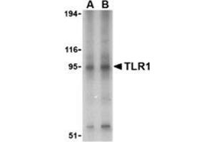 Western blot analysis of TLR1 in Daudi cell lysate with this product at (A) 1 and (B) 2 μg/ml. (TLR1 antibody  (Center))