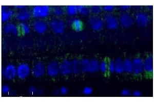 Immunofluorescence (IF) image for anti-Tubulin, beta (TUBB) antibody (ABIN619536)