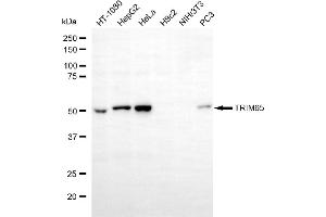 Western blotting analysis using TRIM65 antibody (ABIN7800641). (TRIM65 antibody)