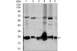 Western blot analysis using ARHGDIA mouse mAb against Jurkat (1), HeLa (2), NIH3T3 (3), C6 (4), K562 (5), and COS7 (6) cell lysate.