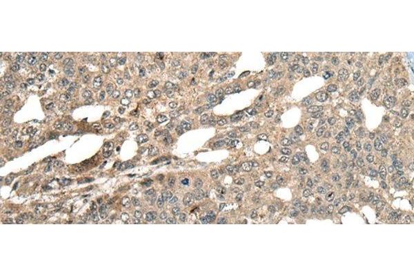 MCPH1 antibody