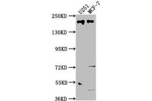 Western Blot Positive WB detected in: U251 whole cell lysate, MCF-7 whole cell lysate All lanes: UNC13B antibody at 1:2000 Secondary Goat polyclonal to rabbit IgG at 1/50000 dilution Predicted band size: 181, 183 kDa Observed band size: 181 kDa