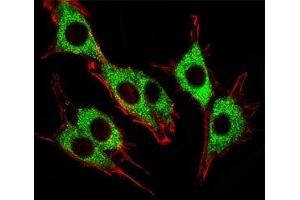 Fluorescent image of PC12 cells stained with Pink1 antibody.