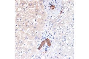 Immunohistochemistry of paraffin-embedded human liver using p53 DINP1 Rabbit mAb (ABIN7271097) at dilution of 1:100 (40x lens).
