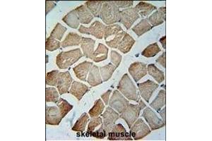 MTX2 Antibody (C-term) (ABIN654751 and ABIN2844433) immunohistochemistry analysis in formalin fixed and paraffin embedded human skeletal muscle followed by peroxidase conjugation of the secondary antibody and DAB staining. (MTX2 antibody  (C-Term))