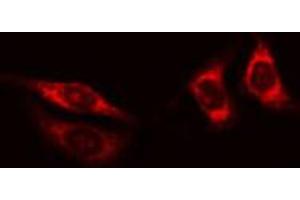 ABIN6268946 staining HT29 cells by IF/ICC. (TXNRD2 antibody  (C-Term))