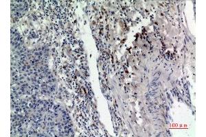 Immunohistochemistry (IHC) analysis of paraffin-embedded Human Lung, antibody was diluted at 1:100. (RAB5 antibody  (Internal Region))